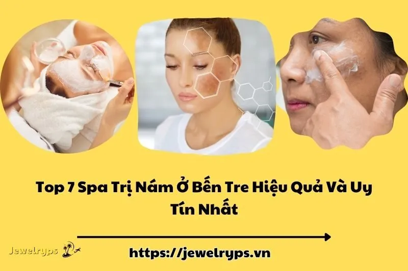 Top 7 Spa Trị Nám Ở Bến Tre Hiệu Quả Và Uy Tín Nhất